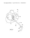 CARDIAC ABLATION DEVICES AND METHODS diagram and image