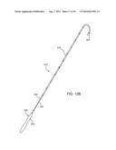 CARDIAC ABLATION DEVICES AND METHODS diagram and image