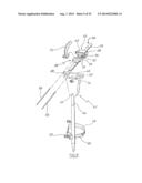 METHOD OF ARTHROPLASTY ON A KNEE JOINT AND APPARATUS FOR USE IN SAME diagram and image