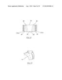 METHOD OF ARTHROPLASTY ON A KNEE JOINT AND APPARATUS FOR USE IN SAME diagram and image