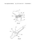 METHOD OF ARTHROPLASTY ON A KNEE JOINT AND APPARATUS FOR USE IN SAME diagram and image