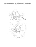 METHOD OF ARTHROPLASTY ON A KNEE JOINT AND APPARATUS FOR USE IN SAME diagram and image