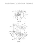 METHOD OF ARTHROPLASTY ON A KNEE JOINT AND APPARATUS FOR USE IN SAME diagram and image