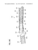 Tissue-Removing Catheter Including Screw Blade and Cutter Driveshaft diagram and image