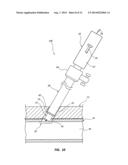 DUAL LUMEN CARRIER TUBE WITH RETRACTABLE SLEEVE AND METHODS diagram and image