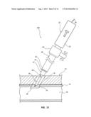 DUAL LUMEN CARRIER TUBE WITH RETRACTABLE SLEEVE AND METHODS diagram and image