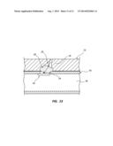 DUAL LUMEN CARRIER TUBE WITH RETRACTABLE SLEEVE AND METHODS diagram and image