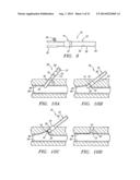 CLOSURE DEVICE AND METHODS FOR MAKING AND USING THEM diagram and image