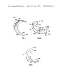 BONE SUPPORT APPARATUS diagram and image