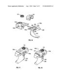 BONE SUPPORT APPARATUS diagram and image