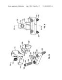 BONE SUPPORT APPARATUS diagram and image