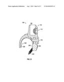 BONE SUPPORT APPARATUS diagram and image