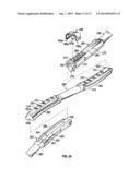 BONE SUPPORT APPARATUS diagram and image