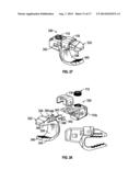 BONE SUPPORT APPARATUS diagram and image