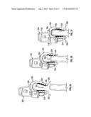 BONE SUPPORT APPARATUS diagram and image