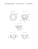 Implant and Fastener Fixation Devices and Delivery Instrumentation diagram and image