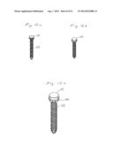 Implant and Fastener Fixation Devices and Delivery Instrumentation diagram and image