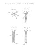 Implant and Fastener Fixation Devices and Delivery Instrumentation diagram and image