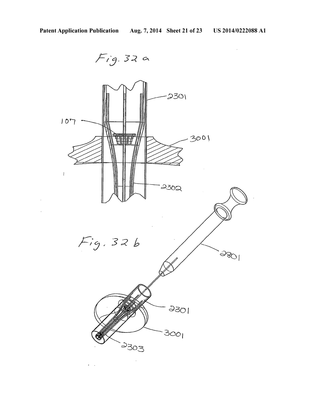 Implant and Fastener Fixation Devices and Delivery Instrumentation - diagram, schematic, and image 22