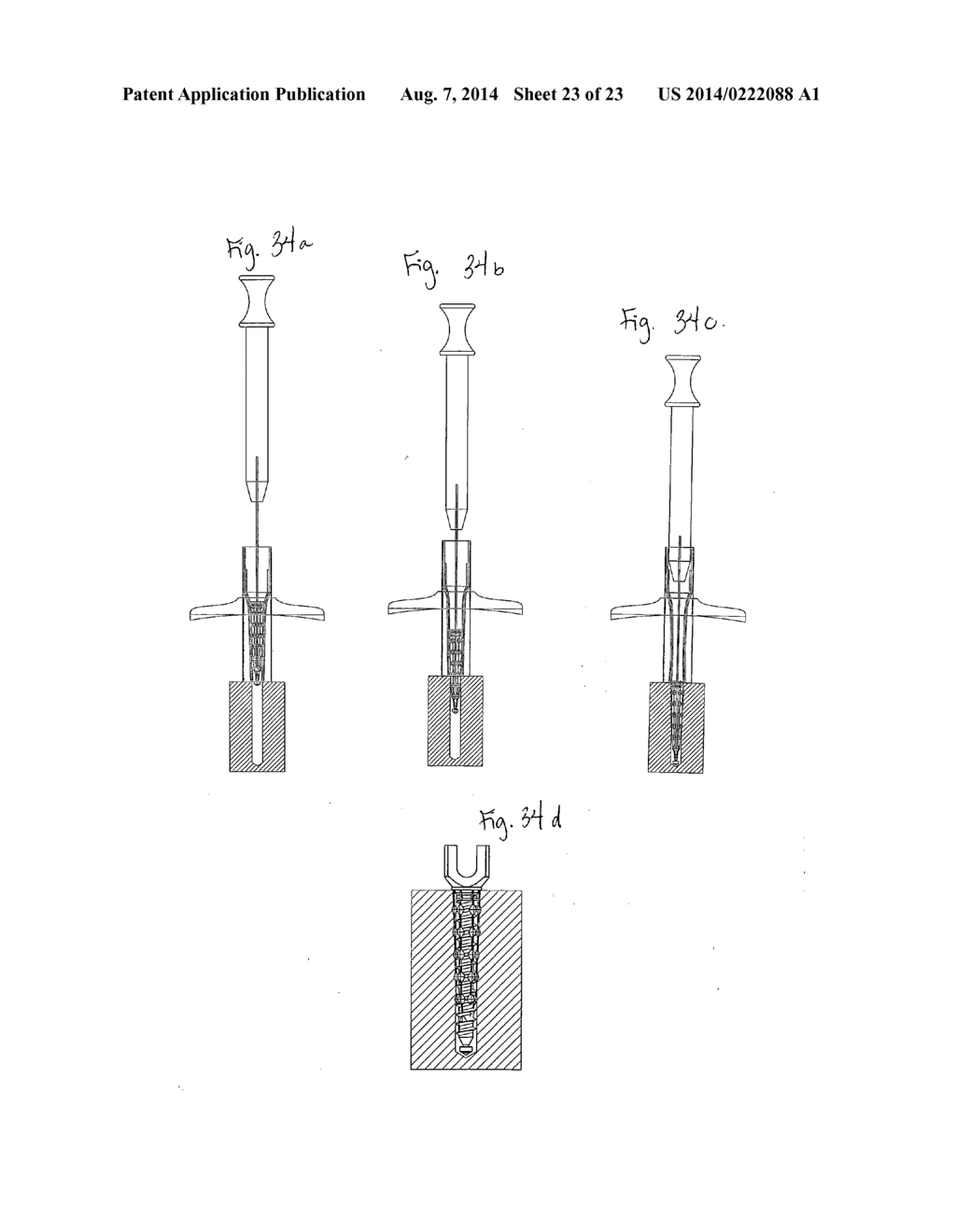 Implant and Fastener Fixation Devices and Delivery Instrumentation - diagram, schematic, and image 24