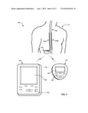 DETERMINATION OF SLEEP QUALITY FOR NEUROLOGICAL DISORDERS diagram and image