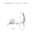 IMPLANTABLE MEDICAL DEVICE PROVIDING STIMULATION THERAPY diagram and image