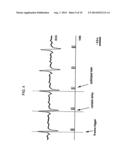 Synchronization Of Vagus Nerve Stimulation With The Cardiac Cycle Of A     Patient diagram and image