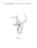 DISINFECTION, DESTRUCTION OF NEOPLASTIC GROWTH, AND STERILIZATION BY     DIFFERENTIAL ABSORPTION OF ELECTROMAGNETIC ENERGY diagram and image