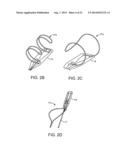 Intravascular Electrodes for Transvenous Stimulation diagram and image