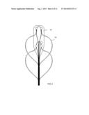 Intravascular Electrodes for Transvenous Stimulation diagram and image