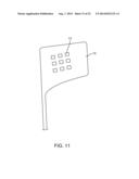 Intravascular Electrodes for Transvenous Stimulation diagram and image