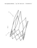 Intravascular Electrodes for Transvenous Stimulation diagram and image