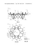 Heart Valve Prosthesis diagram and image