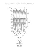 Heart Valve Prosthesis diagram and image