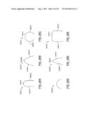 Heart Valve Prosthesis diagram and image