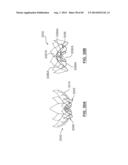 Heart Valve Prosthesis diagram and image