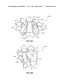 Heart Valve Prosthesis diagram and image