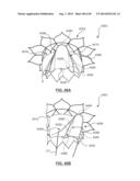 Heart Valve Prosthesis diagram and image