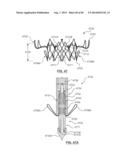 Heart Valve Prosthesis diagram and image