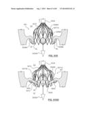 Heart Valve Prosthesis diagram and image