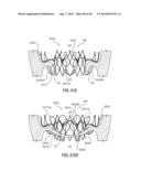 Heart Valve Prosthesis diagram and image