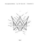 MEDICAL DEVICE FOR TREATING A HEART VALVE INSUFFICENCY diagram and image