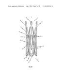 MEDICAL DEVICE FOR TREATING A HEART VALVE INSUFFICENCY diagram and image