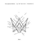 MEDICAL DEVICE FOR TREATING A HEART VALVE INSUFFICENCY diagram and image