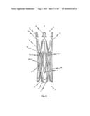 MEDICAL DEVICE FOR TREATING A HEART VALVE INSUFFICENCY diagram and image