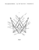 MEDICAL DEVICE FOR TREATING A HEART VALVE INSUFFICENCY diagram and image