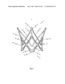 MEDICAL DEVICE FOR TREATING A HEART VALVE INSUFFICENCY diagram and image