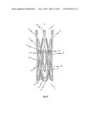 MEDICAL DEVICE FOR TREATING A HEART VALVE INSUFFICENCY diagram and image