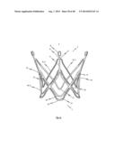 MEDICAL DEVICE FOR TREATING A HEART VALVE INSUFFICENCY diagram and image