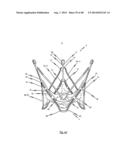 MEDICAL DEVICE FOR TREATING A HEART VALVE INSUFFICENCY diagram and image